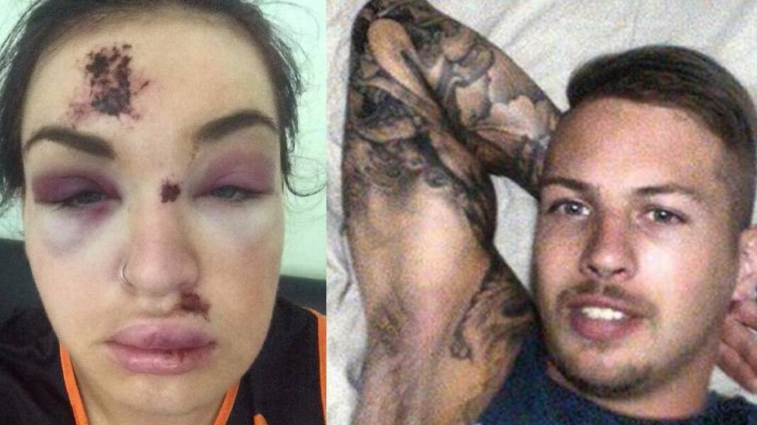 Brittany Merrick's injuries after a night out in Newcastle; and Shaun Rudder who has been found not guilty of the assault.
